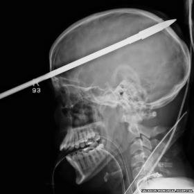 _61009041_spearinhead1.jpg